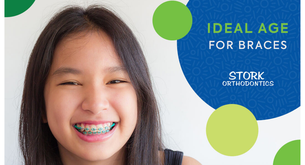 What S The Ideal Age For Braces Stork Orthodontics